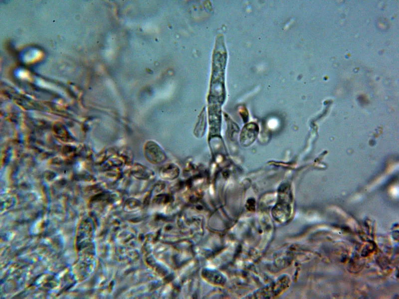 Colacogloea effusa 10 - Basidio 1